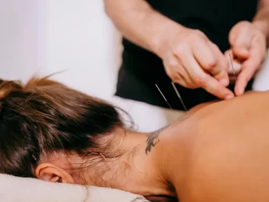 UniSul oferece tratamento da dor com acupuntura em mulheres