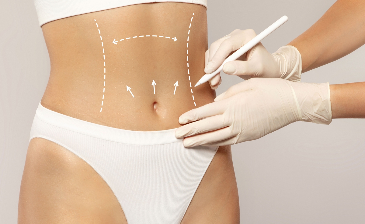 Cirurgia plástica corporal e de rejuvenescimento é tendência