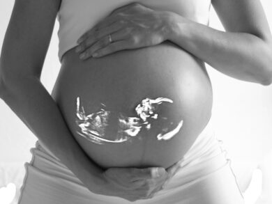 Equipes de cirurgia fetal realizam procedimento inédito