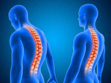 Cirurgia de escoliose é a 1ª com neuronavegação em Uberlândia
