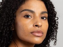 Mês de Conscientização da Acne incentiva cuidados especiais
