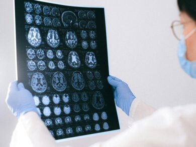 BrainAge: tecnologia indica a idade cerebral